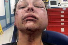 Mulher sofre violência doméstica e publica no Facebook