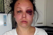 Mulher sofre violência doméstica e publica no Facebook