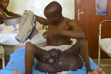 Conheça o homem com os maiores testículos do mundo