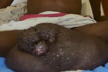 Conheça o homem com os maiores testículos do mundo