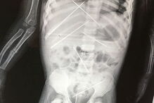 Magia negra, India, criança