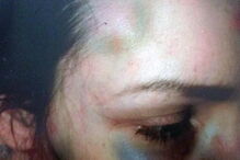 Homem ataca namorada