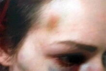 Homem ataca namorada