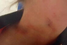 Homem ataca namorada