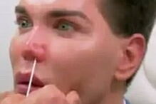 Ken humano, Rodrigo Alves, Botched