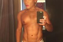 Ken humano, Rodrigo Alves, Botched