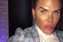 Ken humano, Rodrigo Alves, Botched