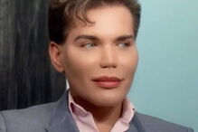 Ken humano, Rodrigo Alves, Botched