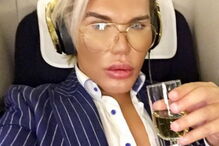 Ken humano, Rodrigo Alves, Botched