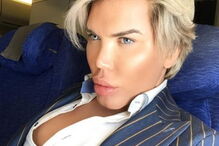 Ken humano, Rodrigo Alves, Botched