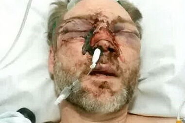 Professor atacado por ex-aluno