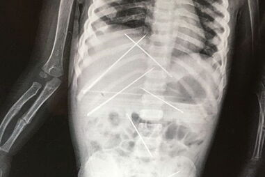 Magia negra, India, criança