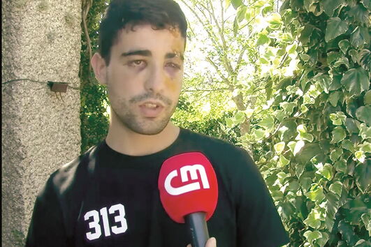 Pedro Taveira foi sovado e pontapeado por um grupo de jovens junto a um bar 