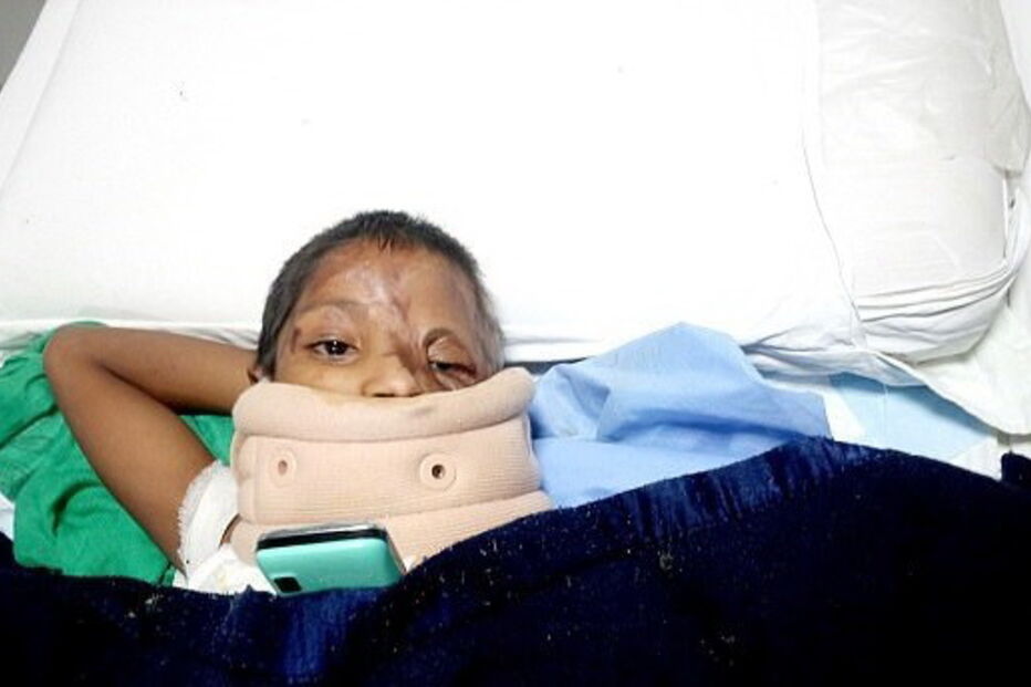 Julie, de 7 anos, foi agora ajudada pela Fundação Chhanv