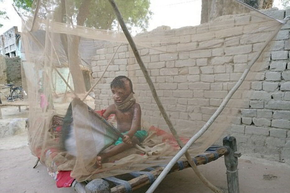 Julie, de 7 anos, foi agora ajudada pela Fundação Chhanv