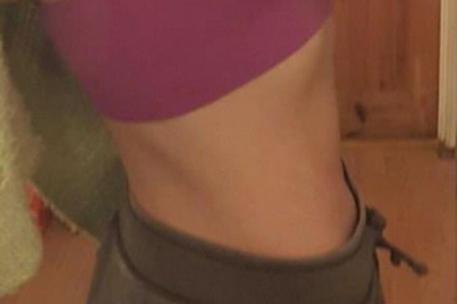 Mulher com endrometriose 