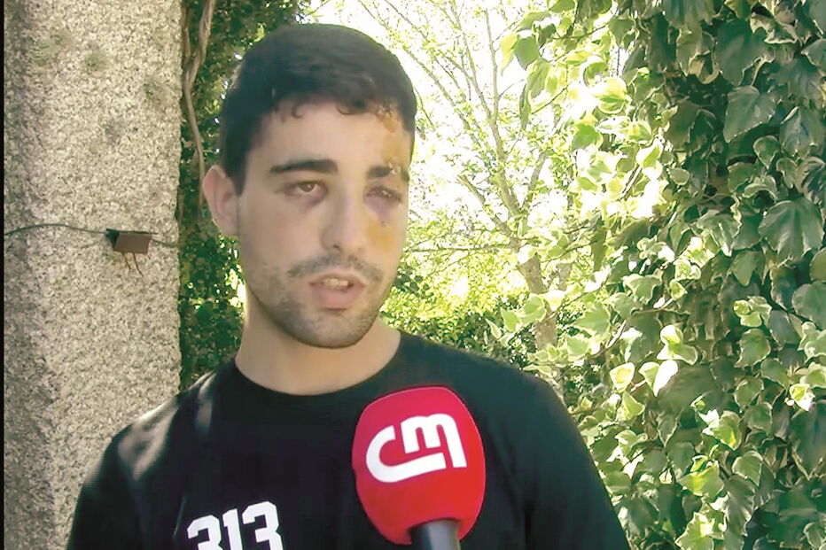 Pedro Taveira foi sovado e pontapeado por um grupo de jovens junto a um bar 