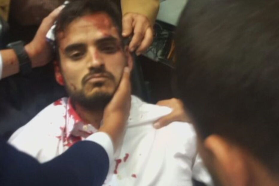 Venezuela, feridos, manifestação, parlamento, Nicolás Maduro 