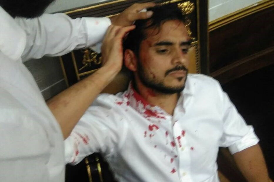 Venezuela, feridos, manifestação, parlamento, Nicolás Maduro 