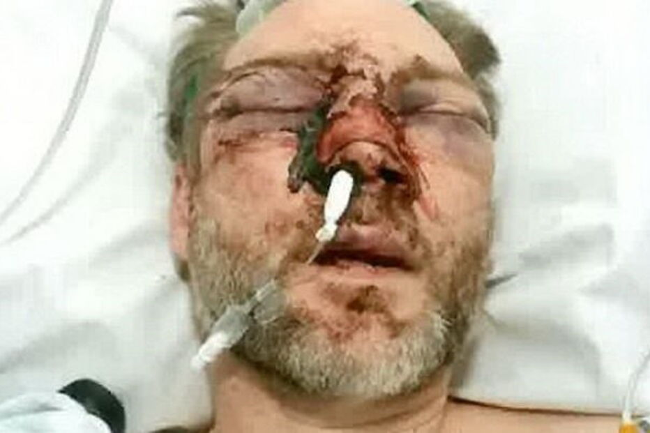 Professor atacado por ex-aluno