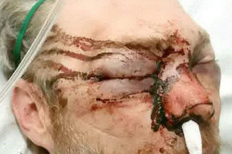 Professor atacado por ex-aluno