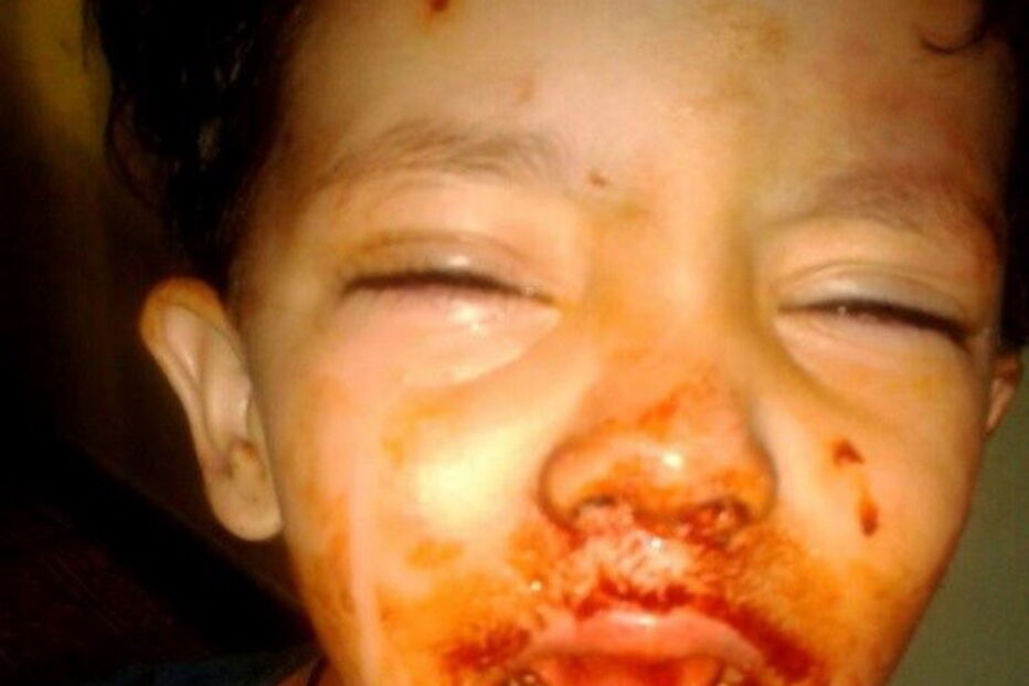 Os médicos acreditam tratar-se de uma condição raríssima.