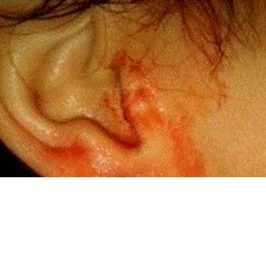 Os médicos acreditam tratar-se de uma condição raríssima.