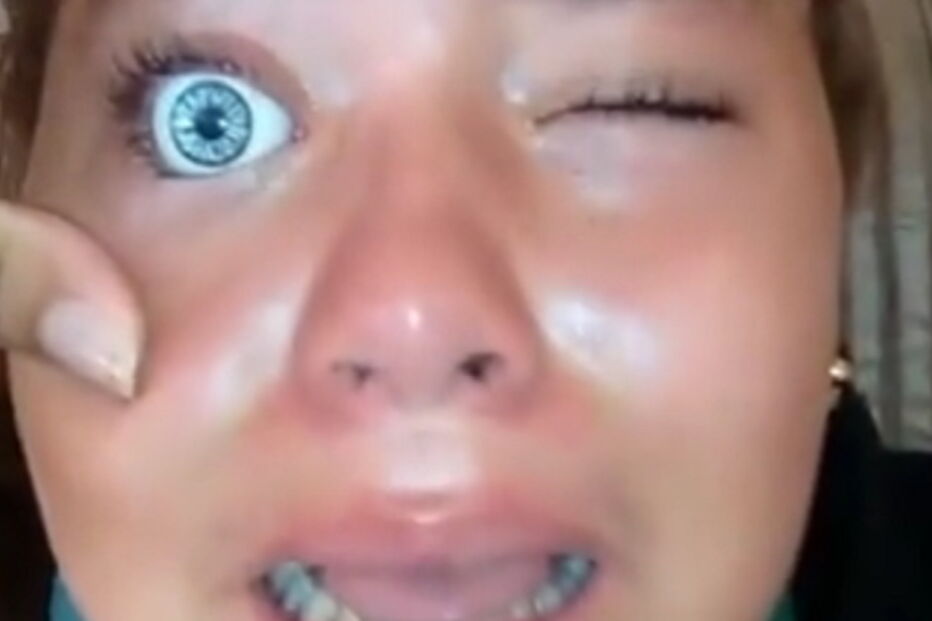 2017-07-09_13_23.27 menina olho de boneca.PNG