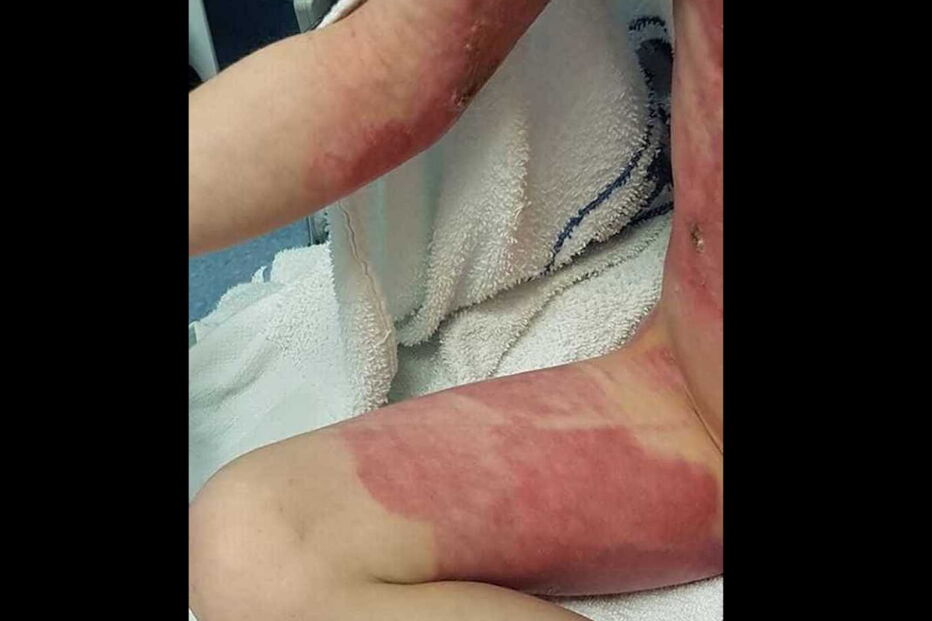 2017-07-09_15_46.03 queimado 1.PNG