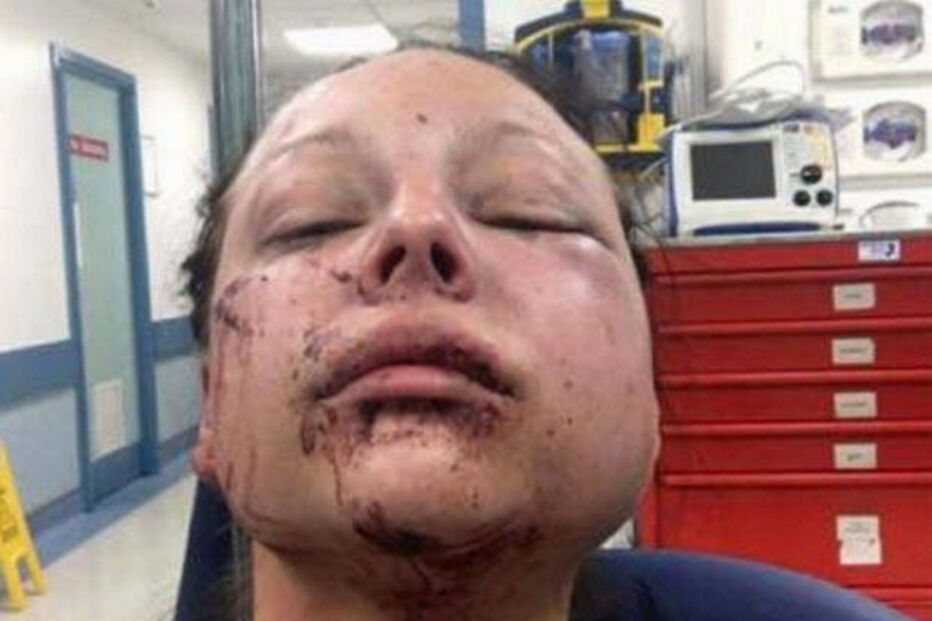 Mulher sofre violência doméstica e publica no Facebook