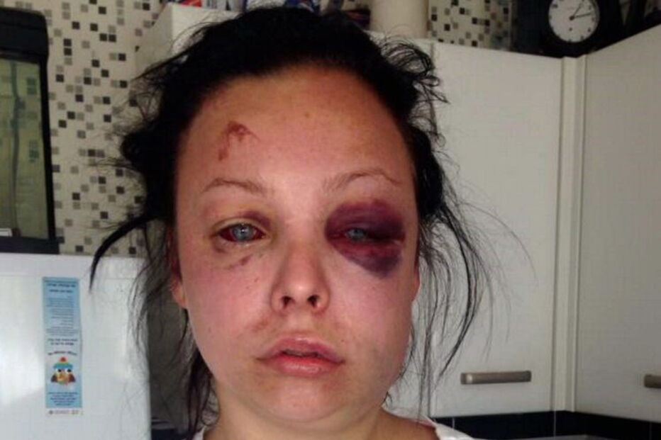 Mulher sofre violência doméstica e publica no Facebook