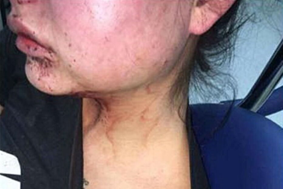 Mulher sofre violência doméstica e publica no Facebook