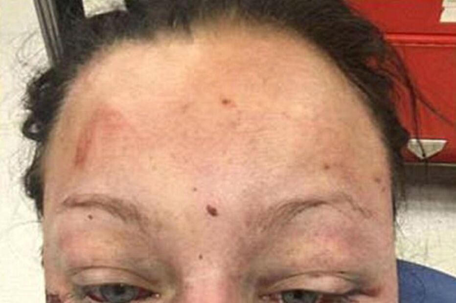 Mulher sofre violência doméstica e publica no Facebook