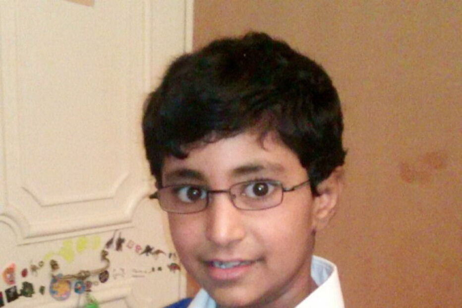 Jovem morre de alergia a queijo 