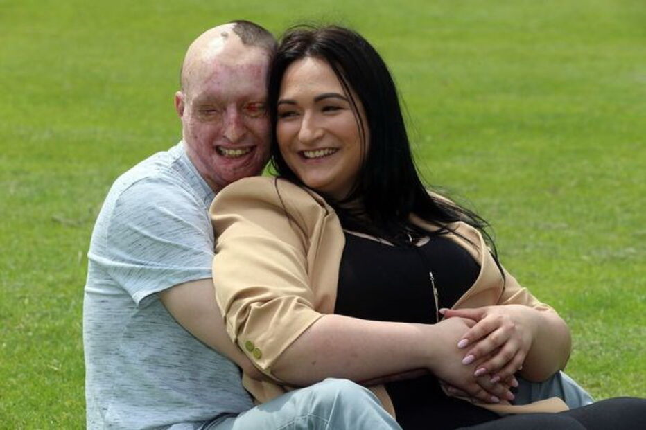 Vítima de ácido, Inglaterra, Daniel Rotariu