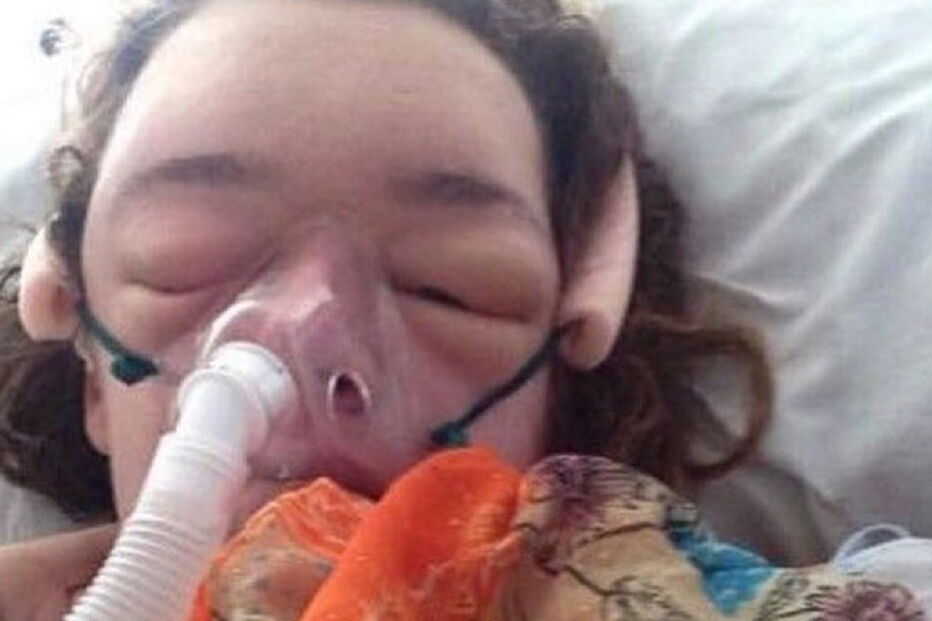 Ela não sabia porque é que os seus pés e mãos não paravam de crescer