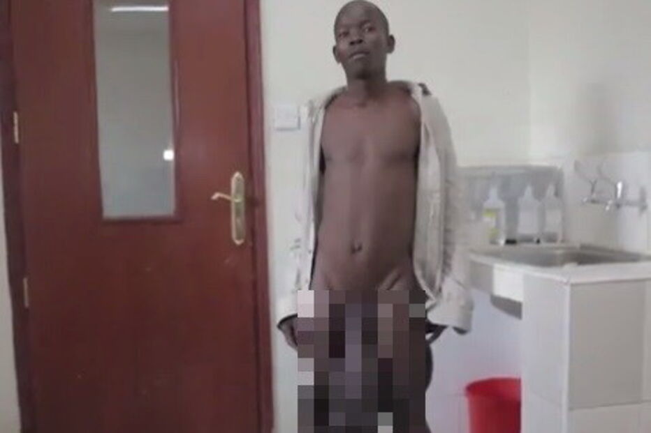 Conheça o homem com os maiores testículos do mundo