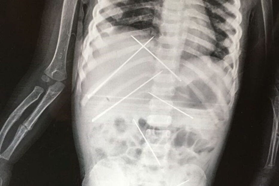 Magia negra, India, criança