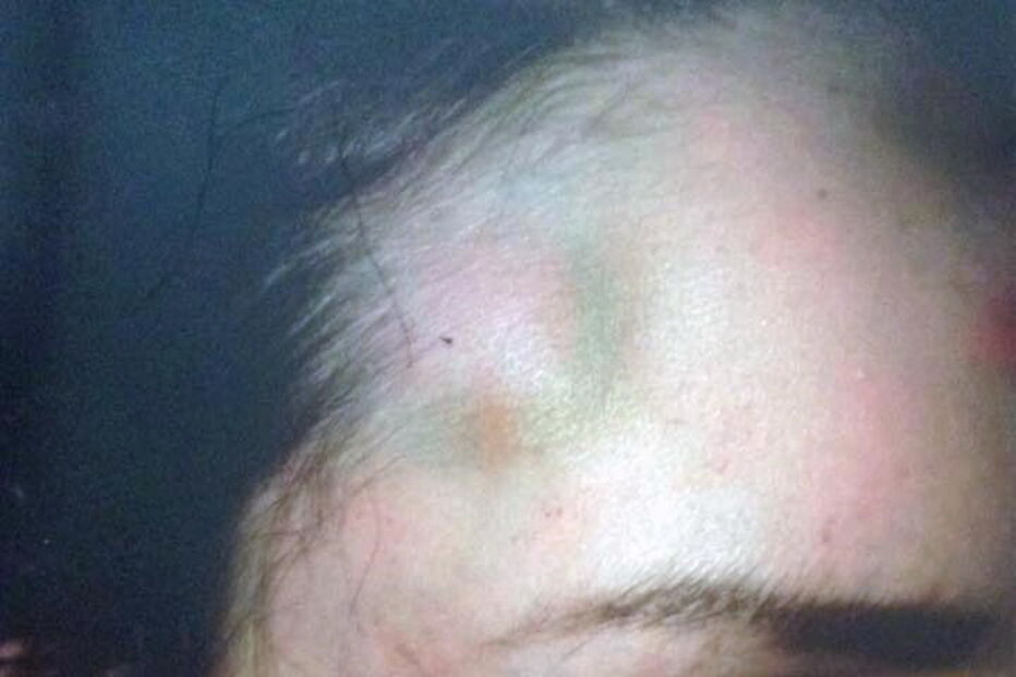 Homem ataca namorada