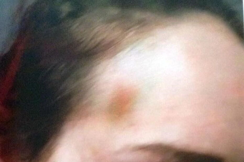 Homem ataca namorada