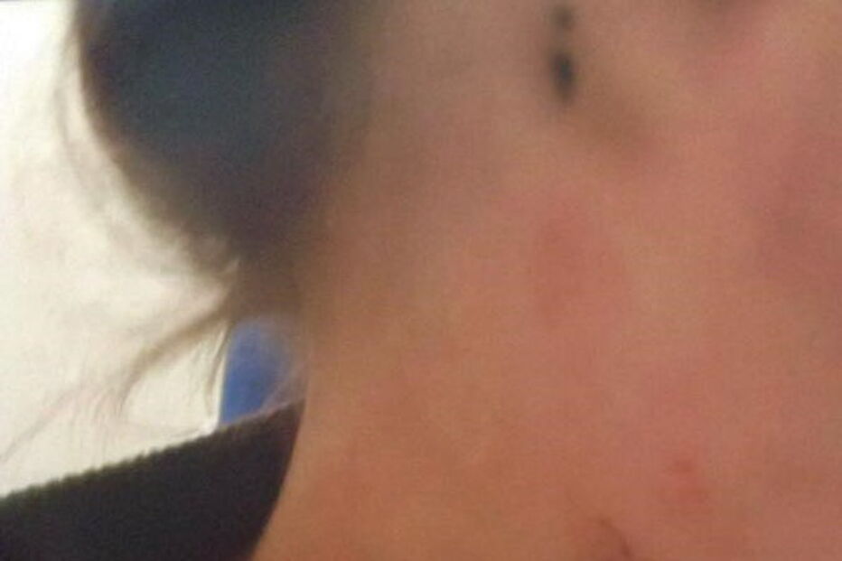 Homem ataca namorada