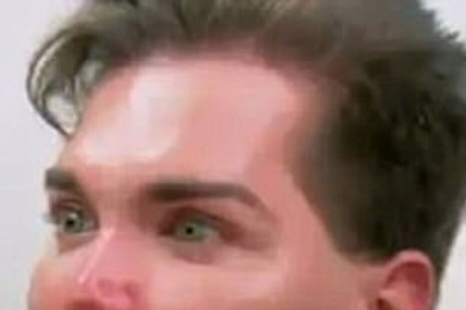 Ken humano, Rodrigo Alves, Botched