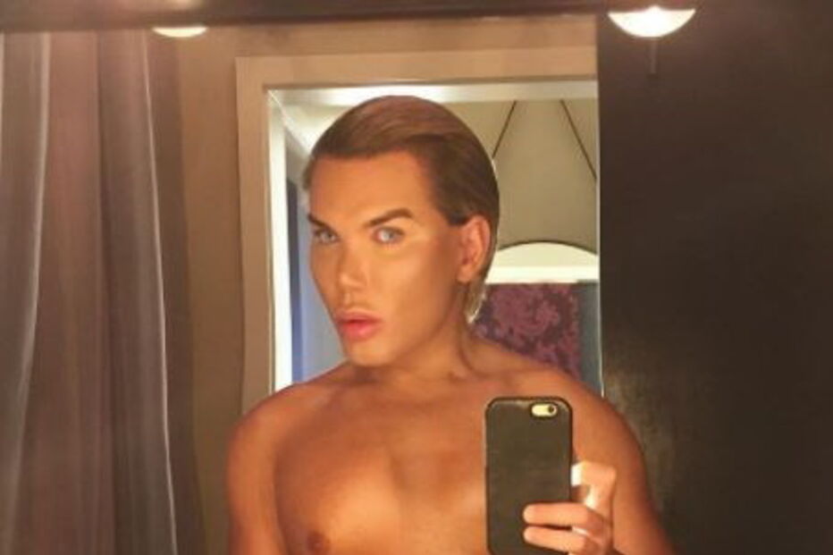 Ken humano, Rodrigo Alves, Botched