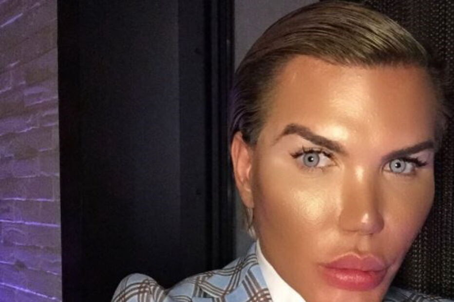 Ken humano, Rodrigo Alves, Botched