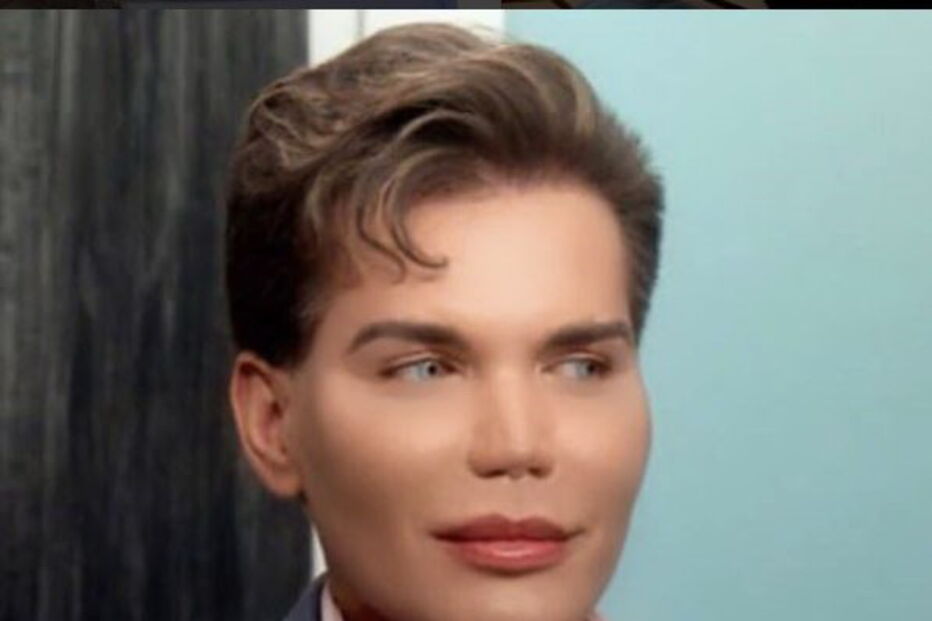 Ken humano, Rodrigo Alves, Botched