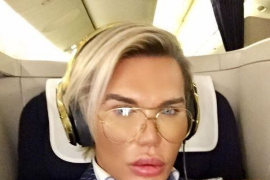 Ken humano, Rodrigo Alves, Botched