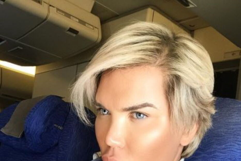 Ken humano, Rodrigo Alves, Botched