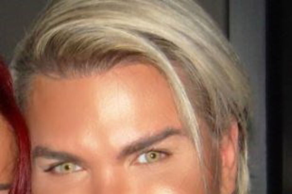 Ken humano, Rodrigo Alves, Botched