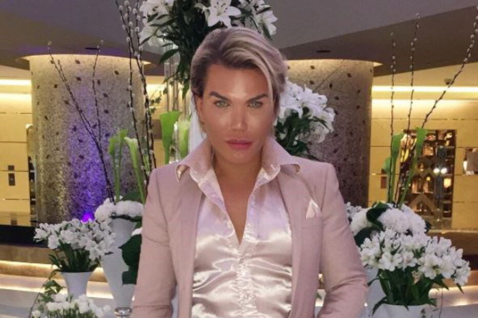 Ken humano, Rodrigo Alves, Botched