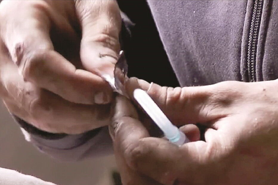 Krokodil é das drogas mais destrutivas 